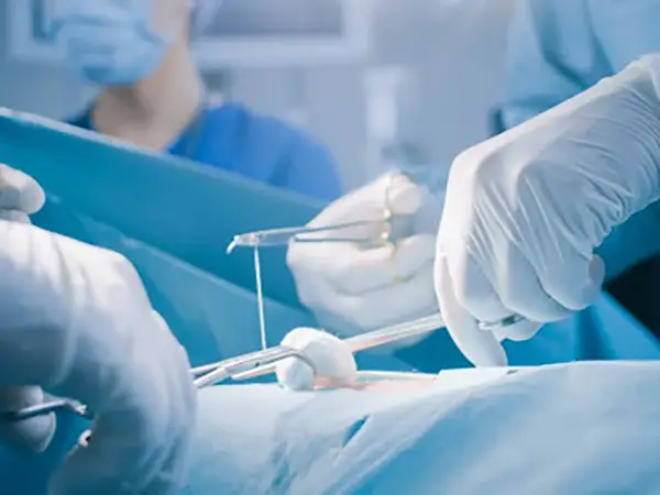 The Evolution of Surgical Sutures